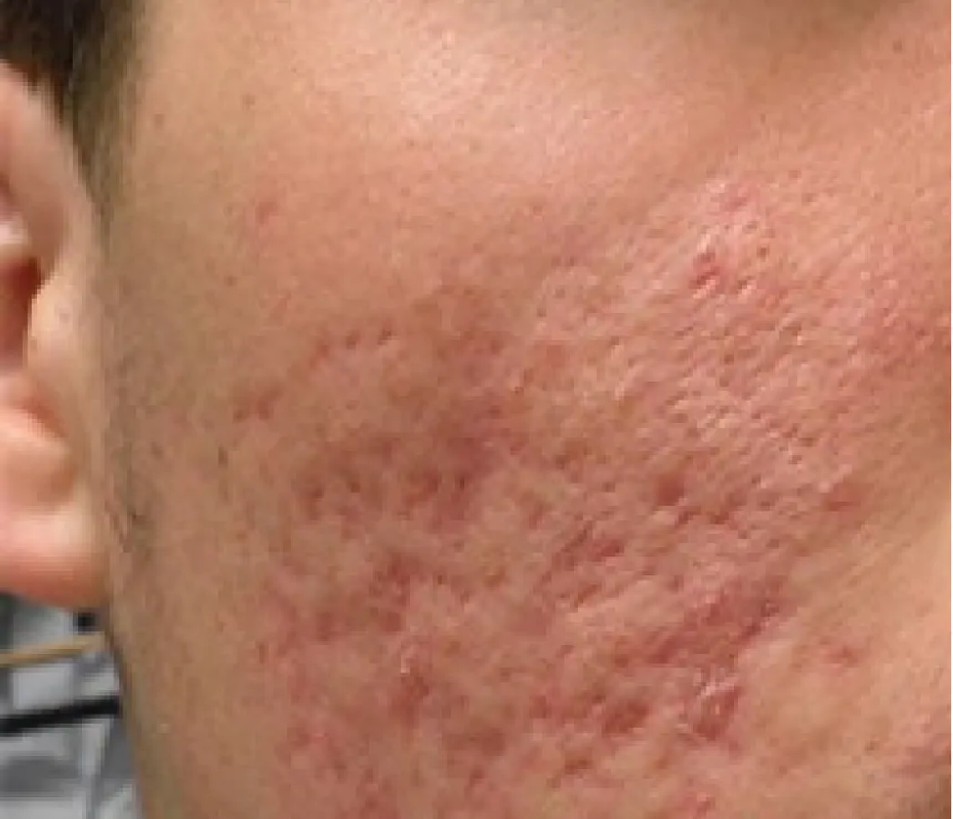 Before and After Results 2