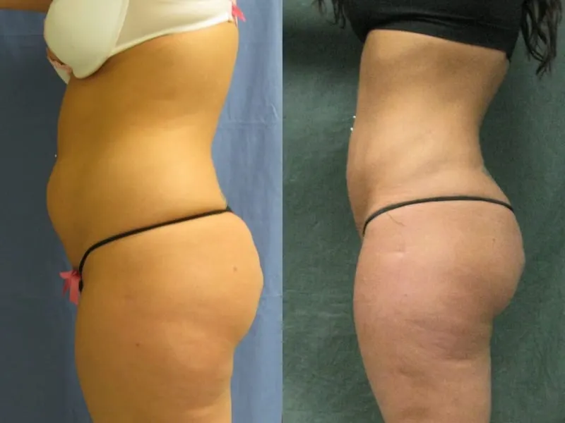 Before and After Results 2